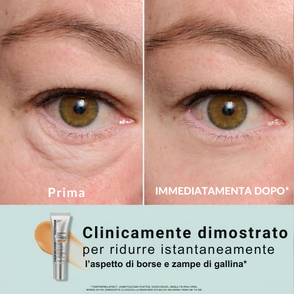 Lumolfit ™ Lifting istantaneo, giovinezza rivelata.