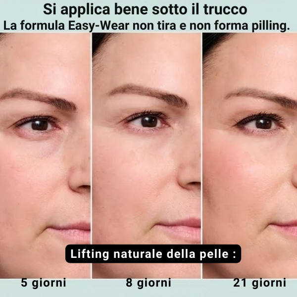 Lumolfit ™ Lifting istantaneo, giovinezza rivelata.